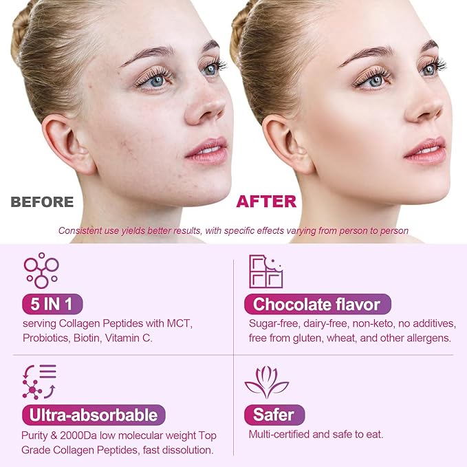 Collagen Protein Coffee Creamer Powder, Marine Collagen Peptides with Coconut Mct Oil for Hair Skin & Nails Support, Non Dairy, Sugar Free, Keto Friendly, Chocolate Flavor, 500g (20 Servings)